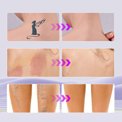 💜Limited Sale BUY 1 GET 1 FREE!! 💜All-in-one moisturizer, concealer & coverage Perfector