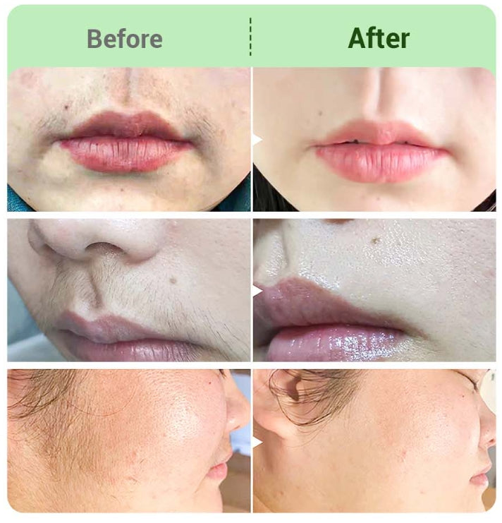 BUY 2 GET 1 FREE🤩Hair Removal Cream Kit for Women🤩