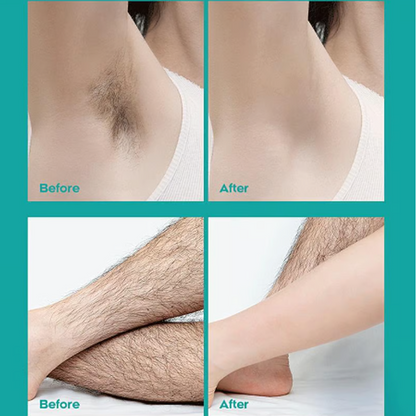 🔥Limited Sale-Buy 1 Get 1 Free!🎁Painless Full Body Hair Removal Cream 💧✨