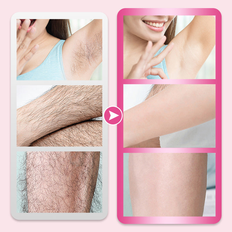 Flawless & Gentle Hair Removal Cream