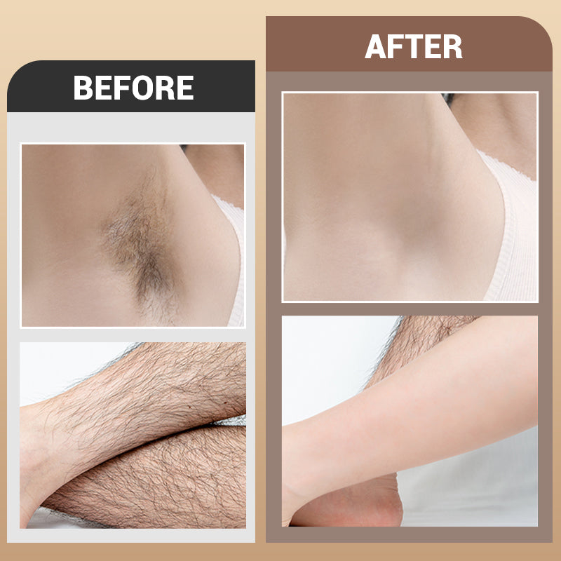 🎁 Hot Sale 49% OFF 🔥Gentle Hair Removal Cream—suitable for multiple body parts